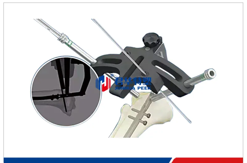 PEEK rod holder for intramedullary nail surgery